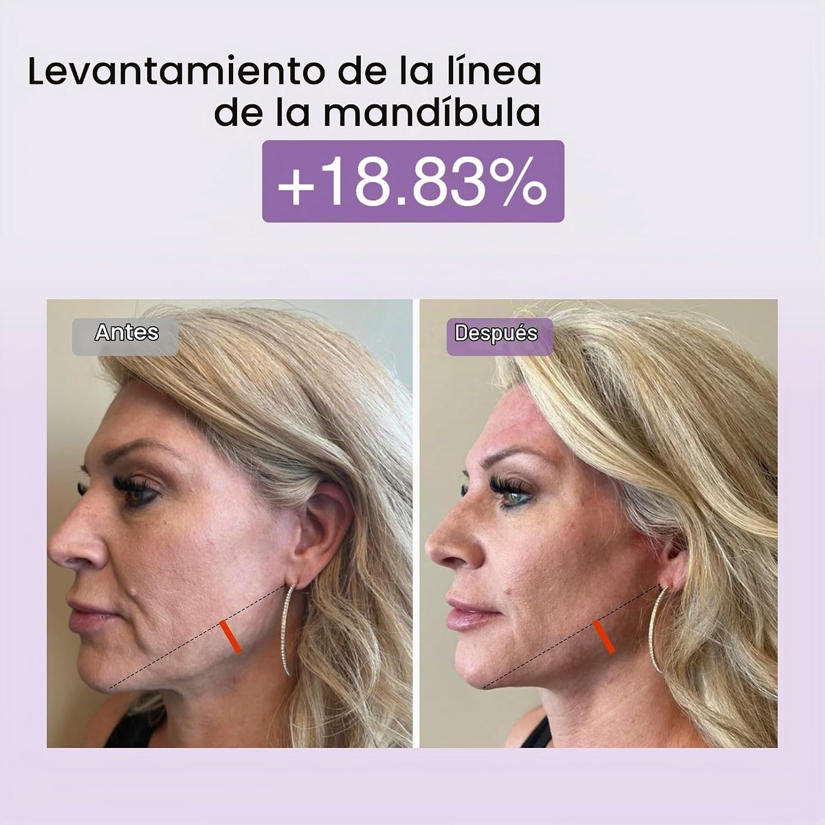 DermRays Dispositivo multifuncional de microcorriente con luz | EMS...