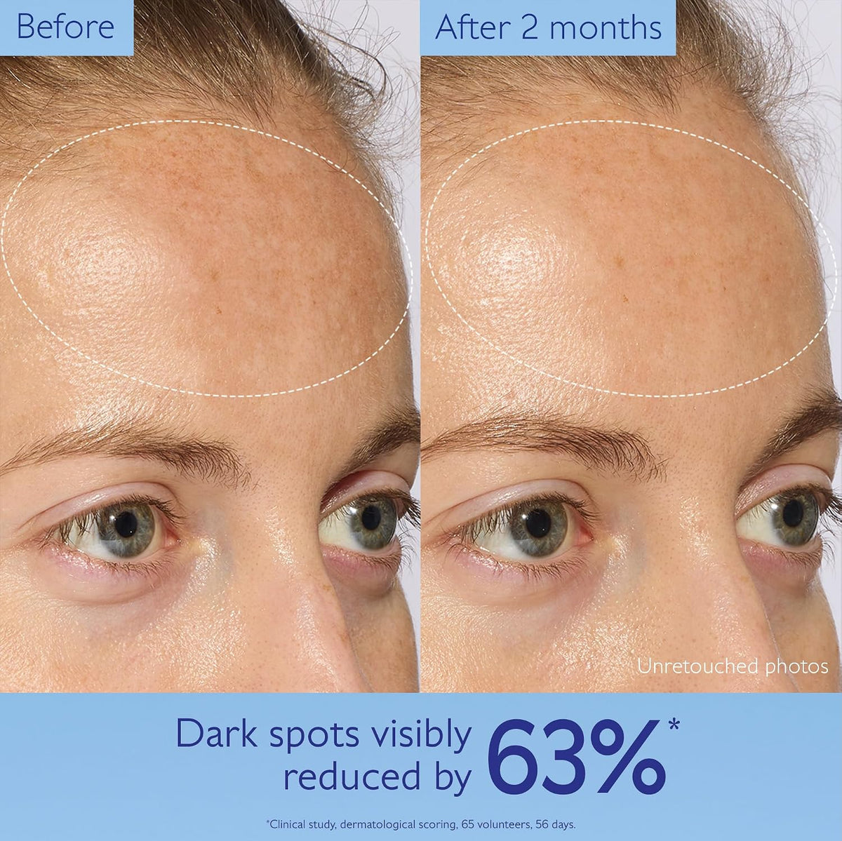 Caudalie Vinoperfect - Suero iluminador de manchas oscuras alternat...