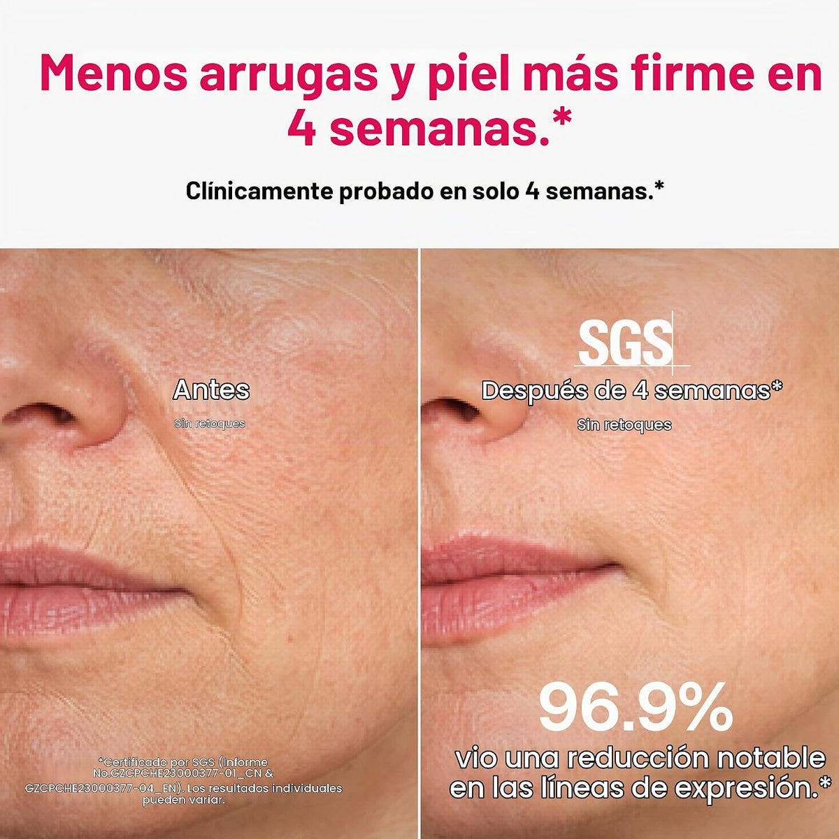 Máscara de terapia de luz roja Ulike para rostro, cobertura facial...