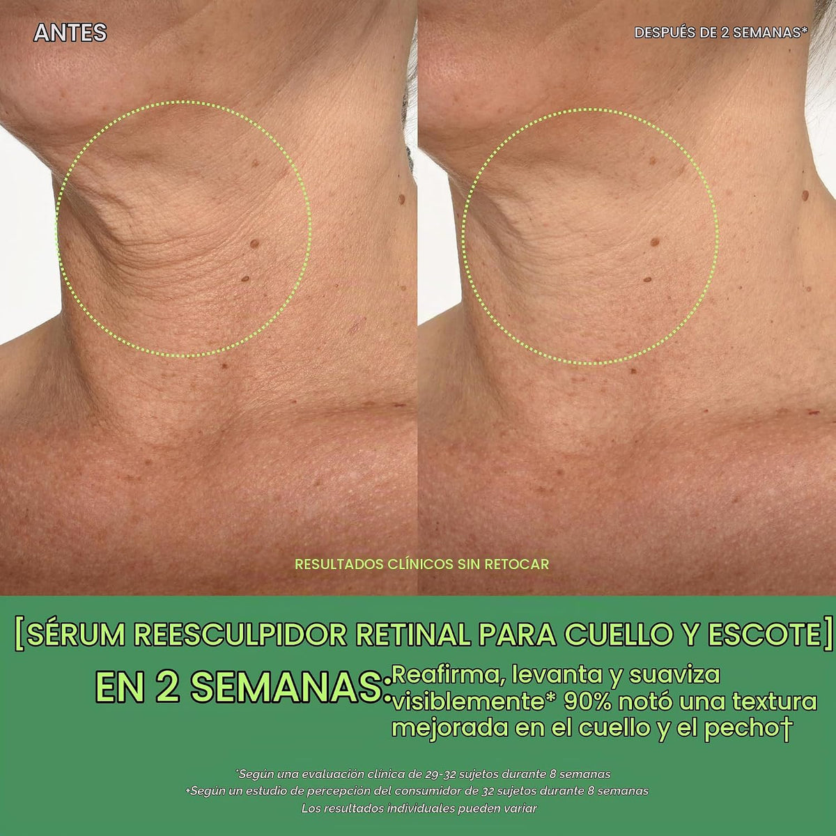 Murad Retinal Resculpt Neck & Decollete Lifting Serum - Retinal - 1...
