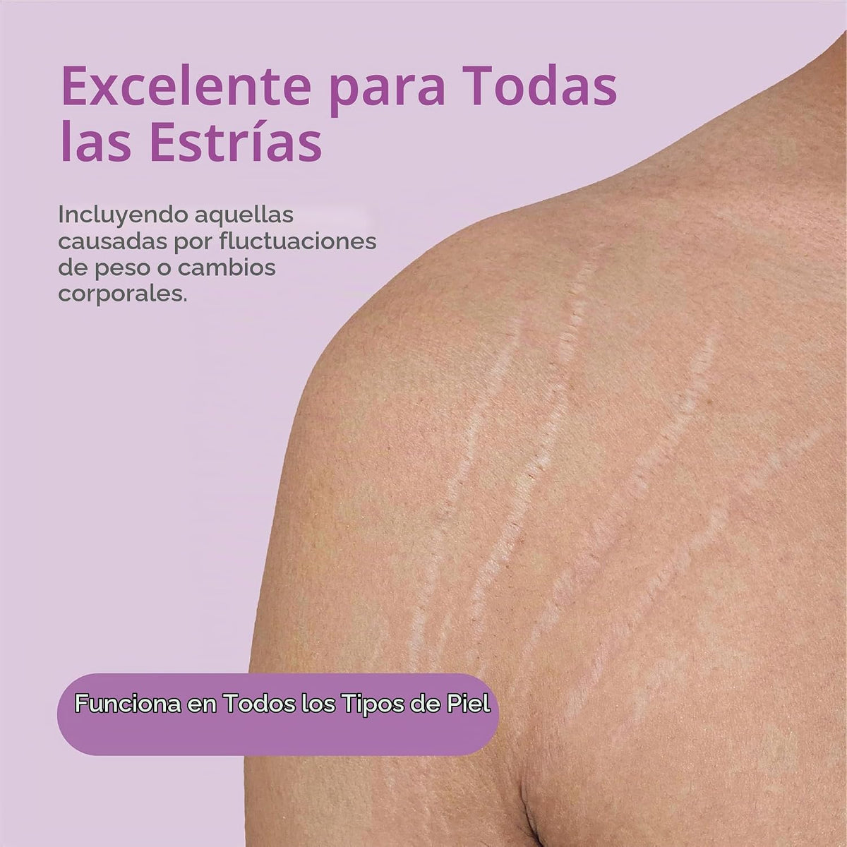 TriLASTIN Acelerador hidrotérmico \u2013 Suero de preparación de la...