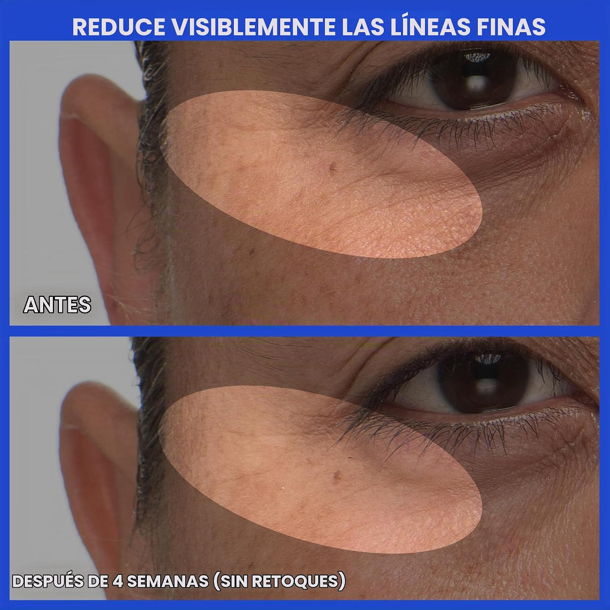 innisfree Suero PDRN de té verde | Cuidado de la piel coreano con r...