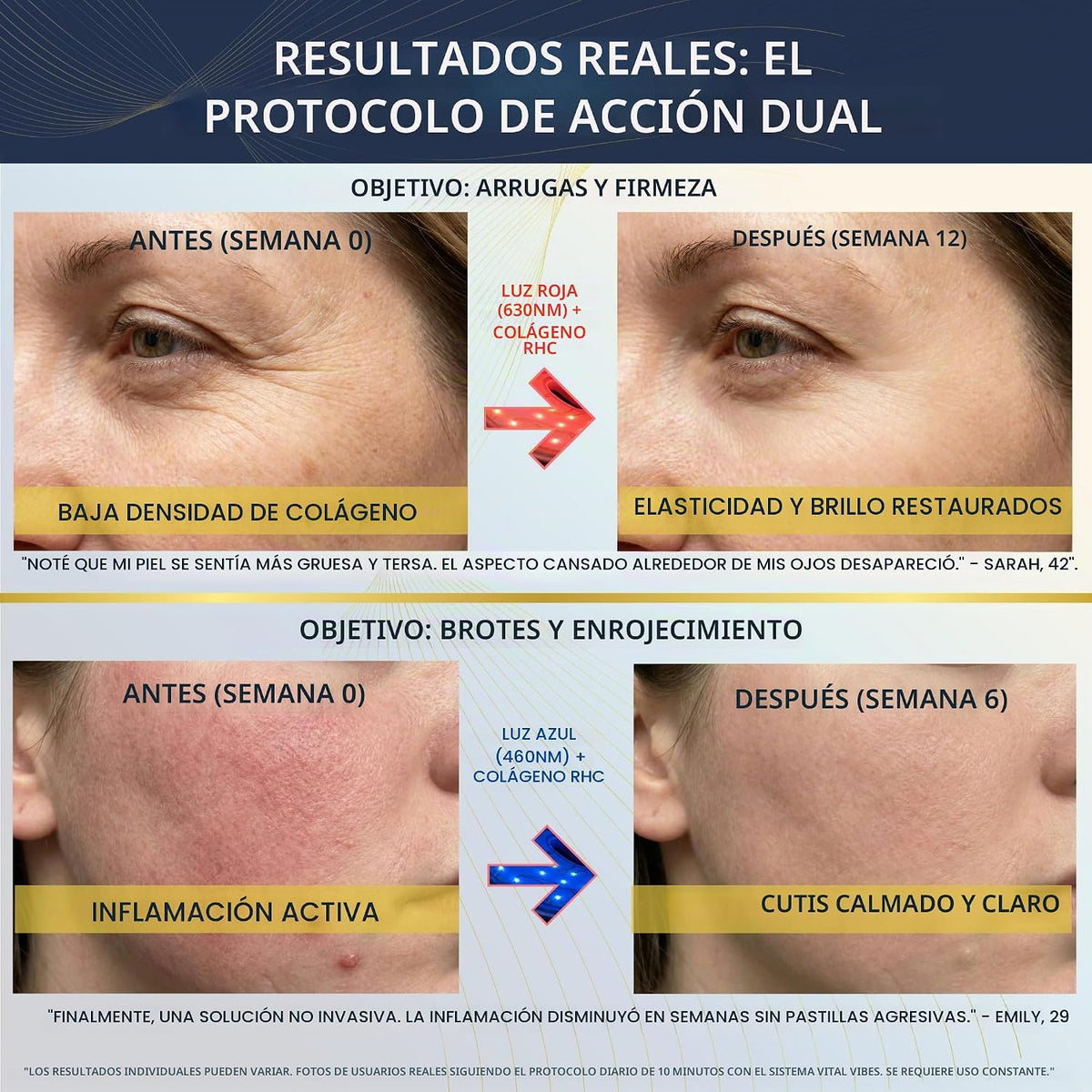 Vital Vibes Máscara facial LED para terapia de luz roja aprobada po...