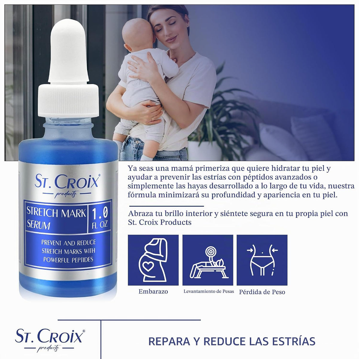 Sérum para estrías - Previene y reduce la aparición de estrías - 1 oz