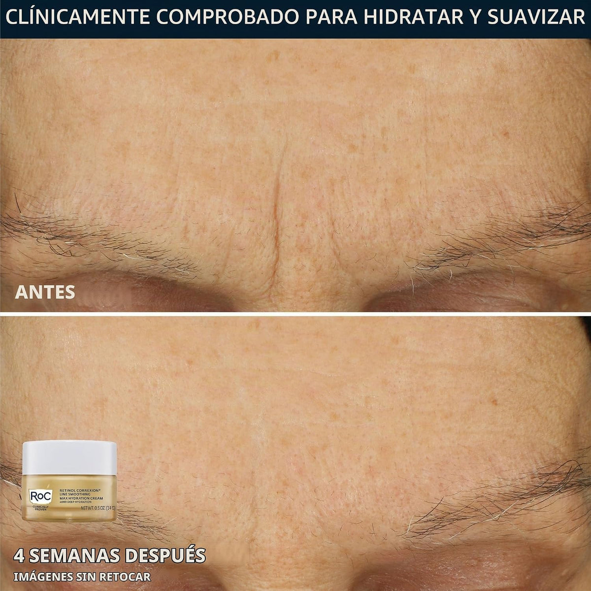 RoC Clinical Mini Retinol Kit de rutina para el cuidado de la piel...