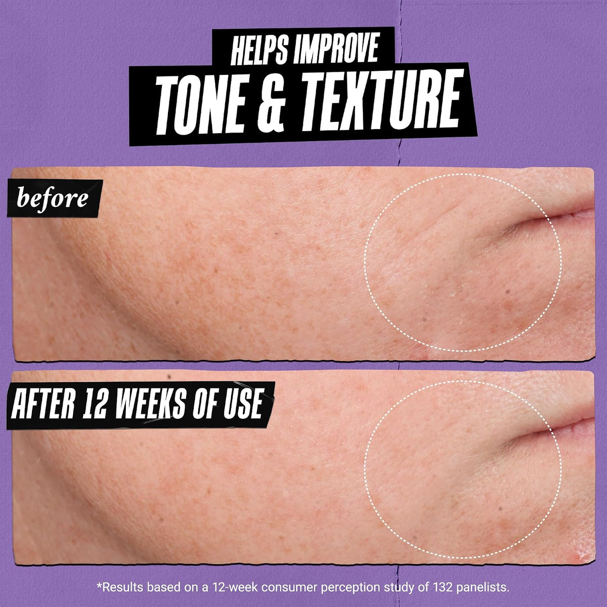 Kiehl's Suero facial de retinol antienvejecimiento de microdosi...
