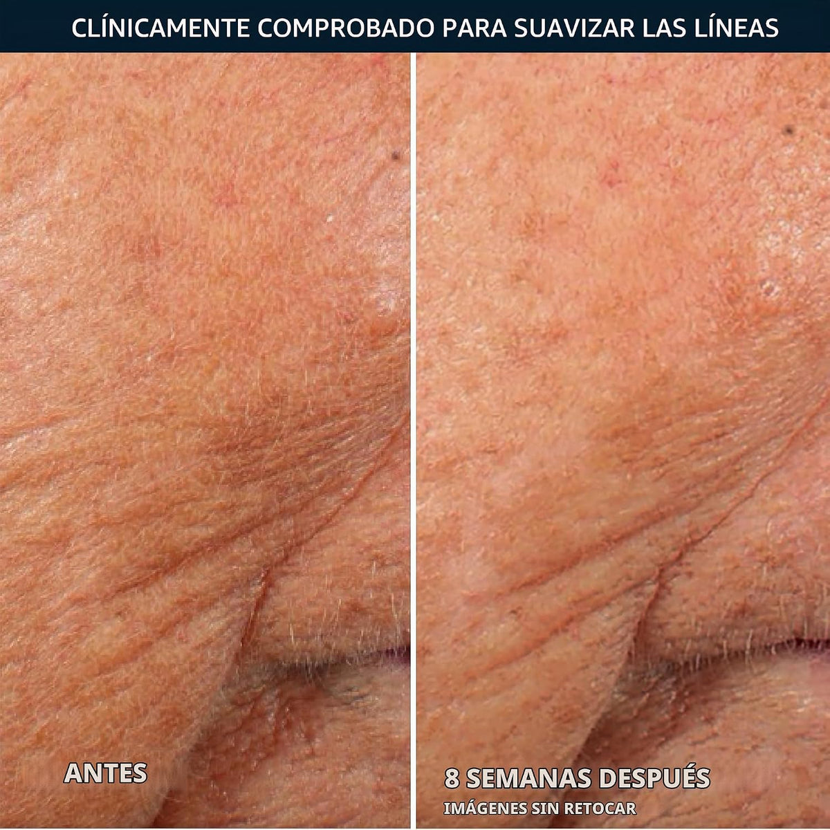 RoC Retinol Correxion Cápsulas de suero nocturno antienvejecimiento...