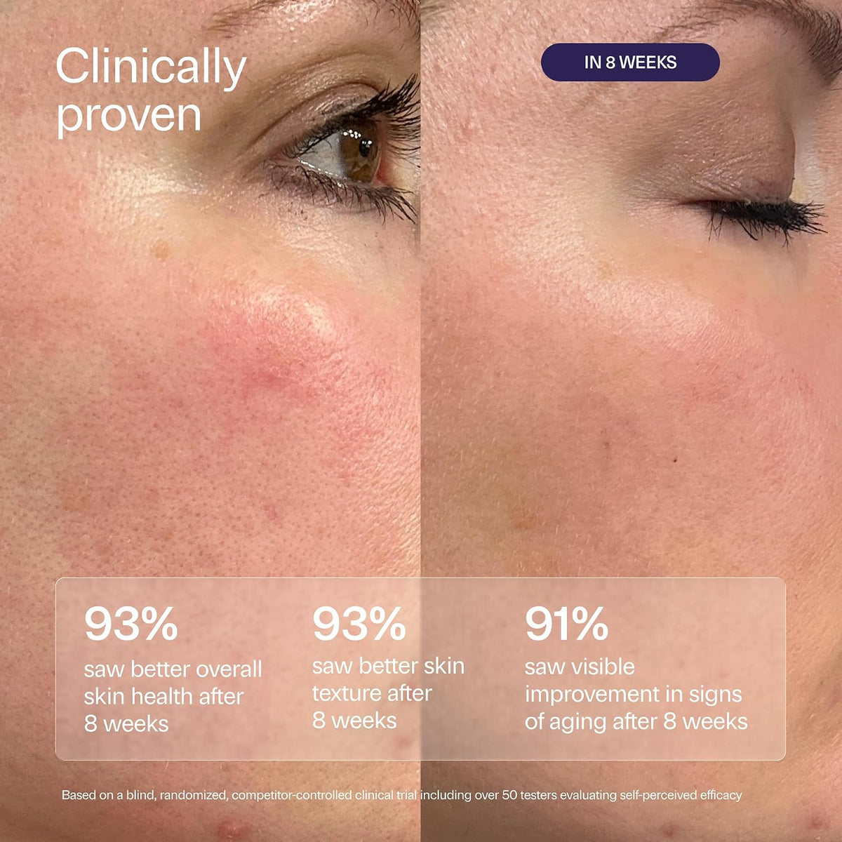 Wildfleur Suero de retinol al 0,3% para la cara, BR0.3 Bakuchiol su...