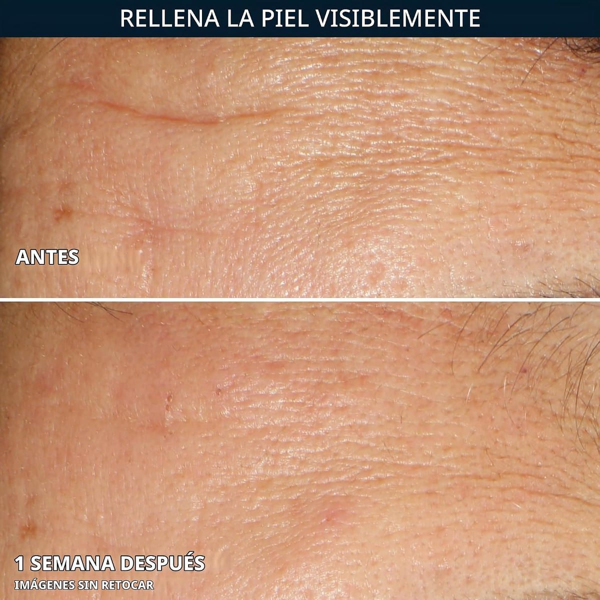 RoC Multi Correxion - Cápsulas de suero nocturno de ácido hialuróni...