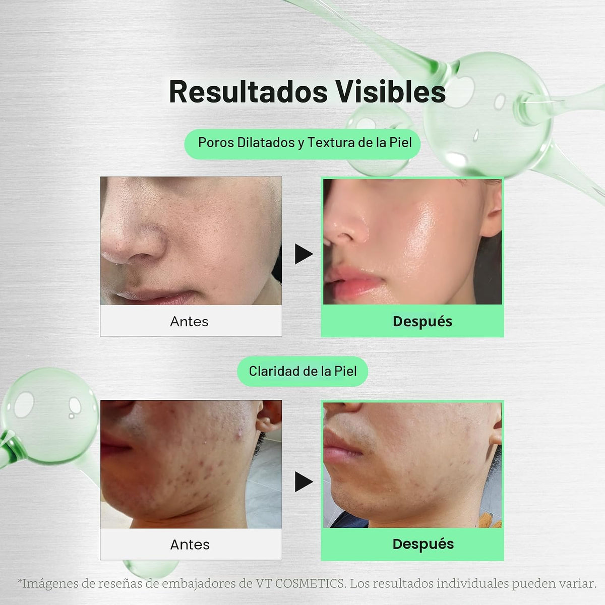 VT COSMETICS CICA Reedle Shot 700, suero de microagujas con espícul...