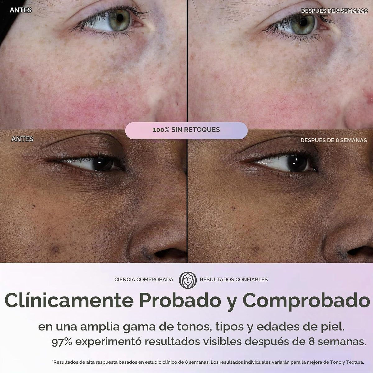 Olay Super Serum - Suero brillante para la cara, niacinamida activa...