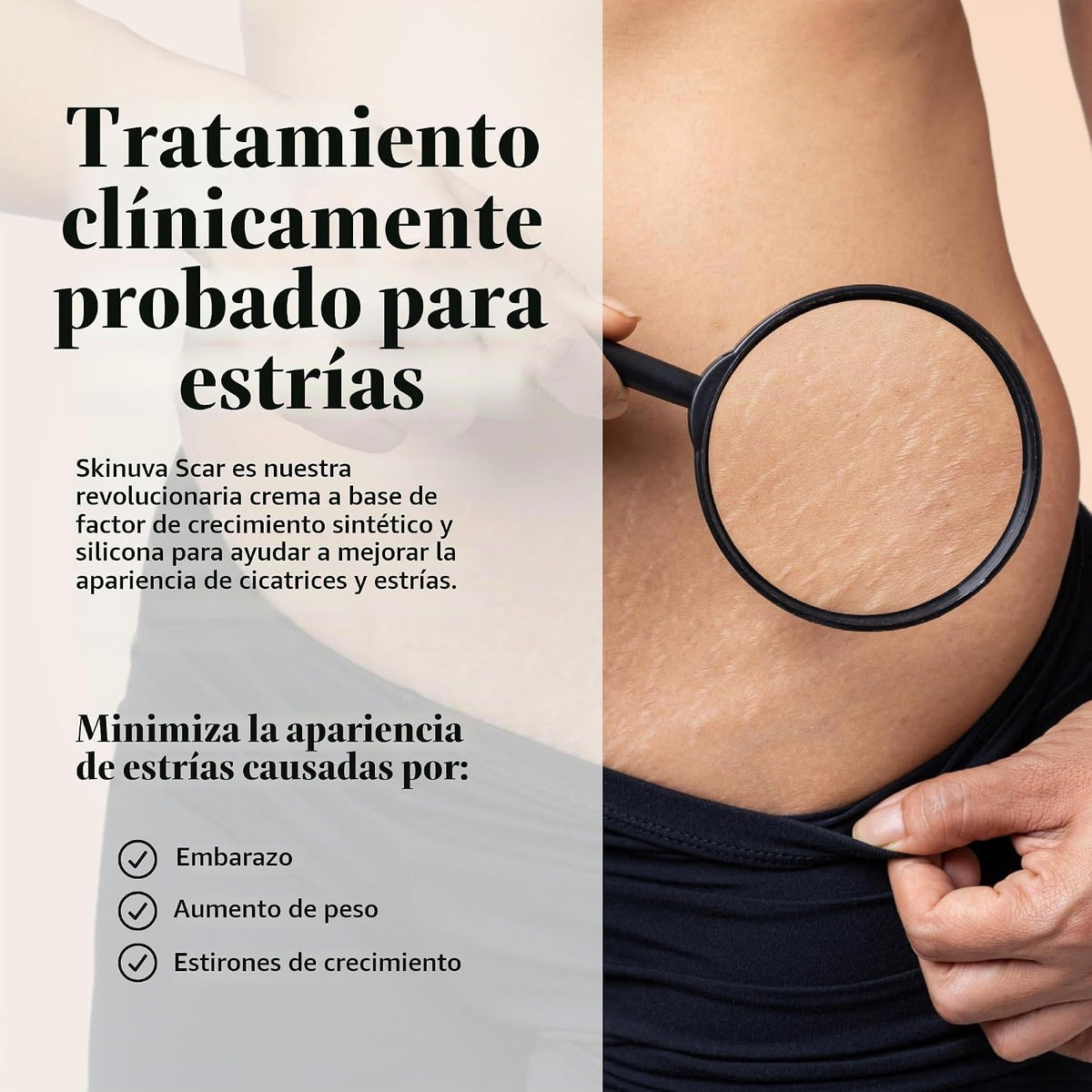 Skinuva® Crema para estrías (2.5 oz) | Ayuda a mejorar la aparienci...