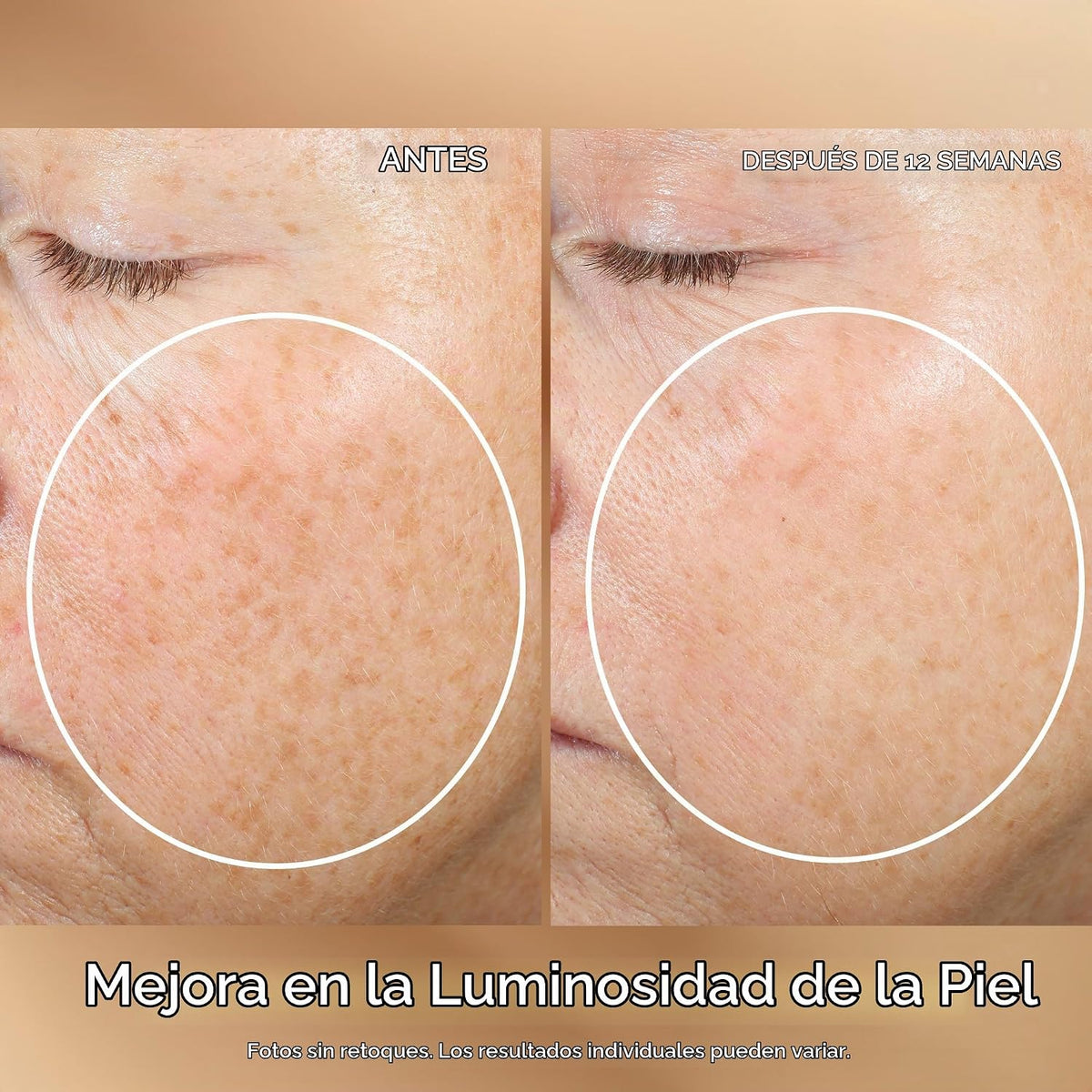 StriVectin Multi Action Super C Retinol Suero Iluminador y Corrector