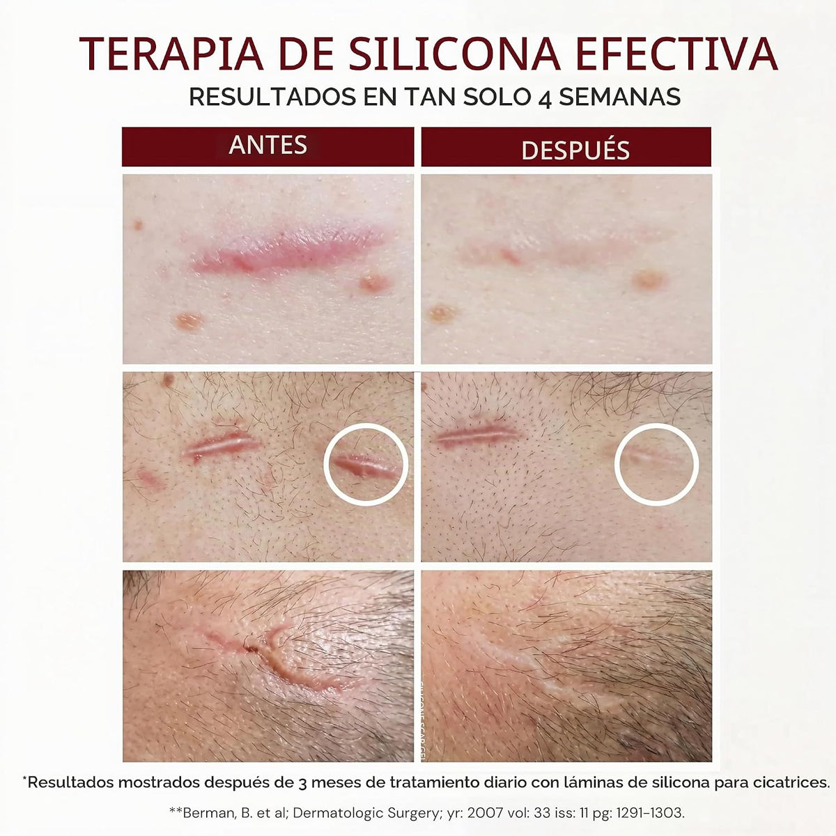 HealFast Gel de silicona para cicatrices, crema para cicatrices qui...