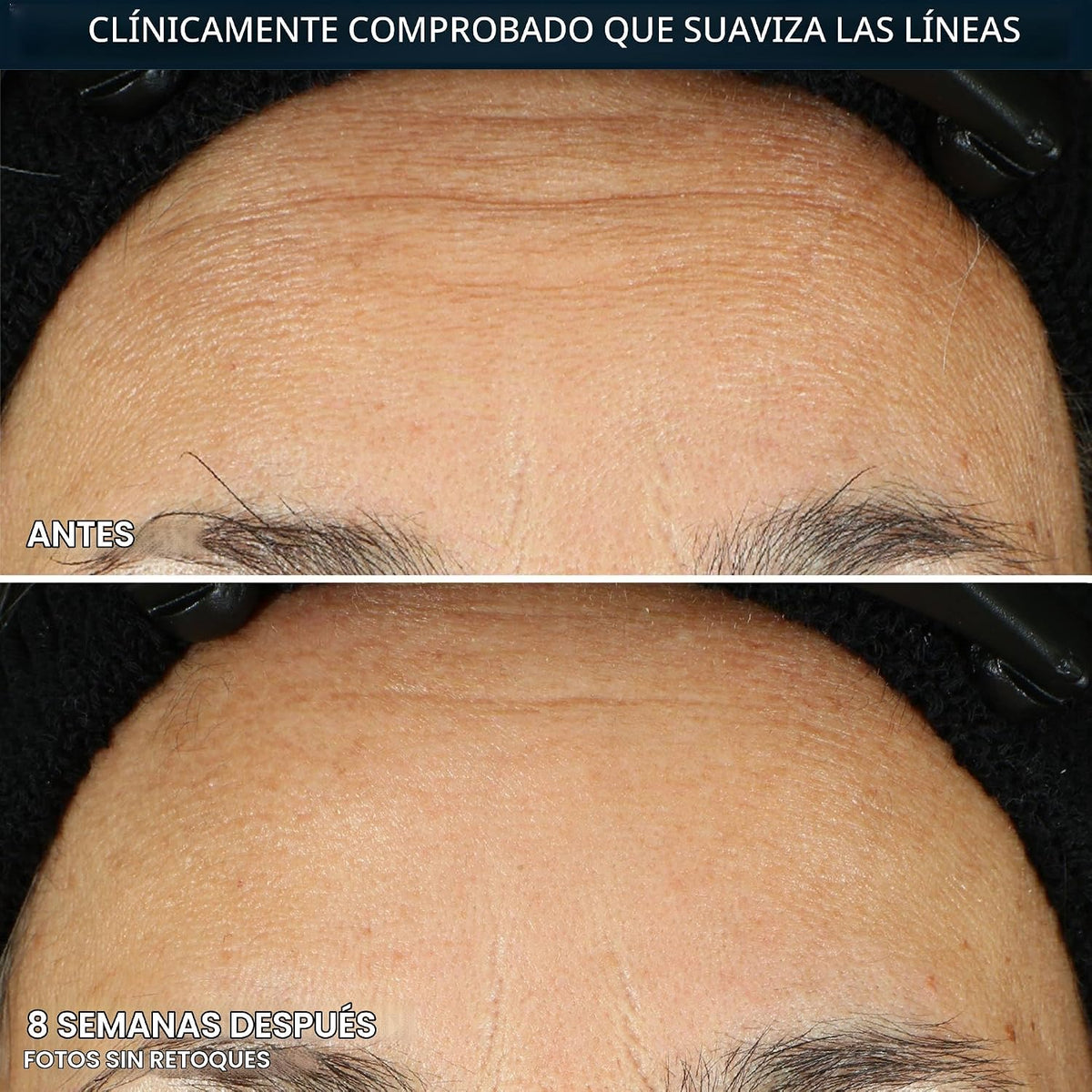 RoC Retinol Correxion Line - Cápsulas de suero de noche suavizante,...