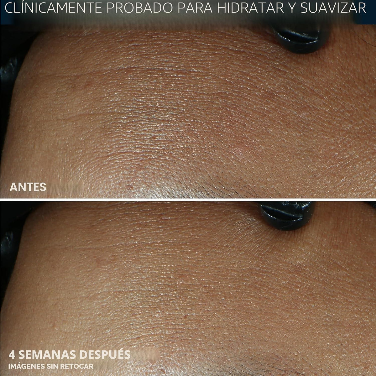 RoC Retinol Correxion Max Hidratante facial de hidratación diaria,...