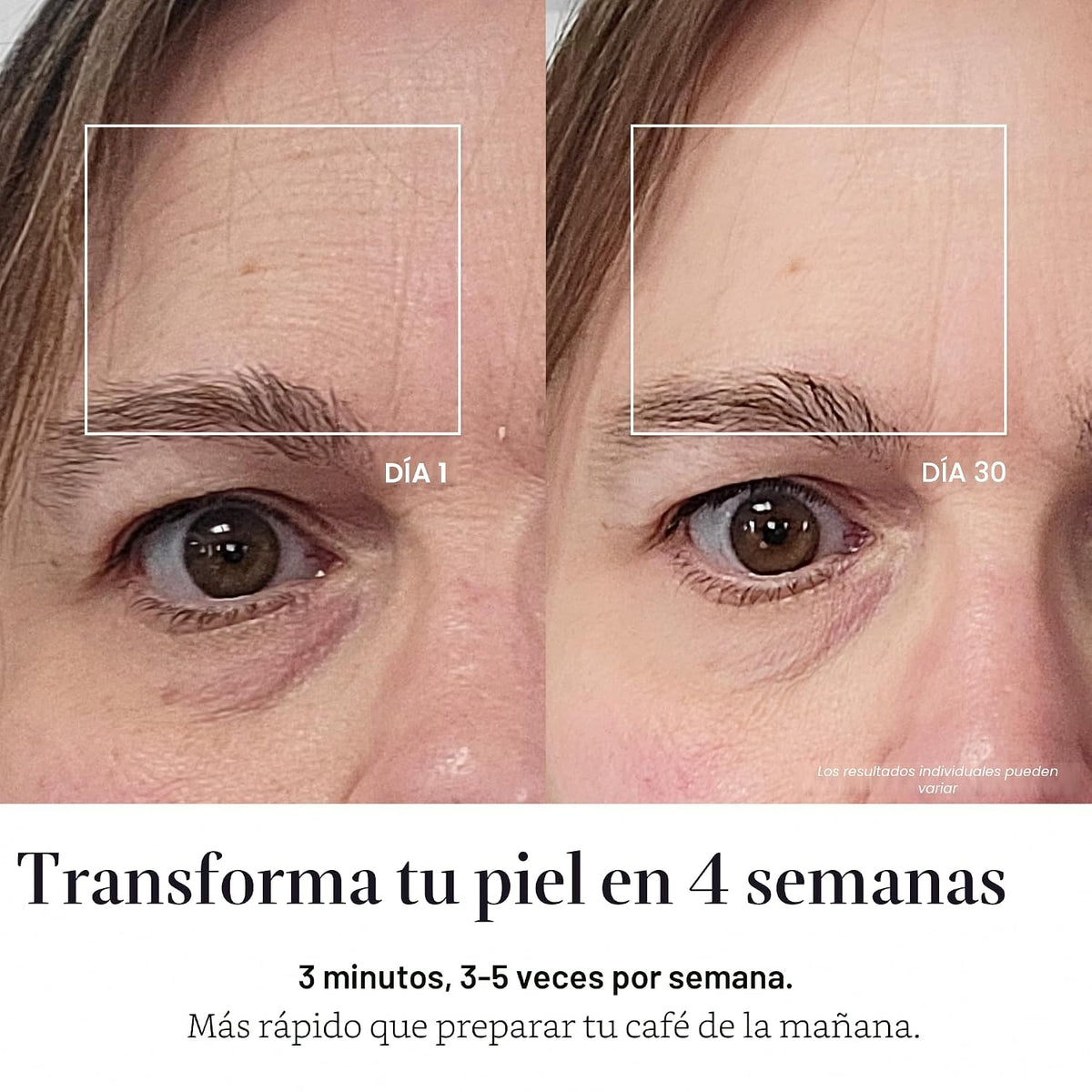 Solawave Máscara facial de terapia de luz roja | Máscara de luz roj...