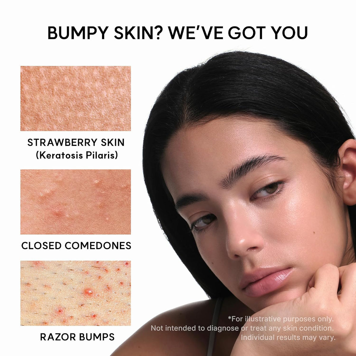 Arencia Erasor Shot - Tónico exfoliante de ácido glicólico al 10% +...