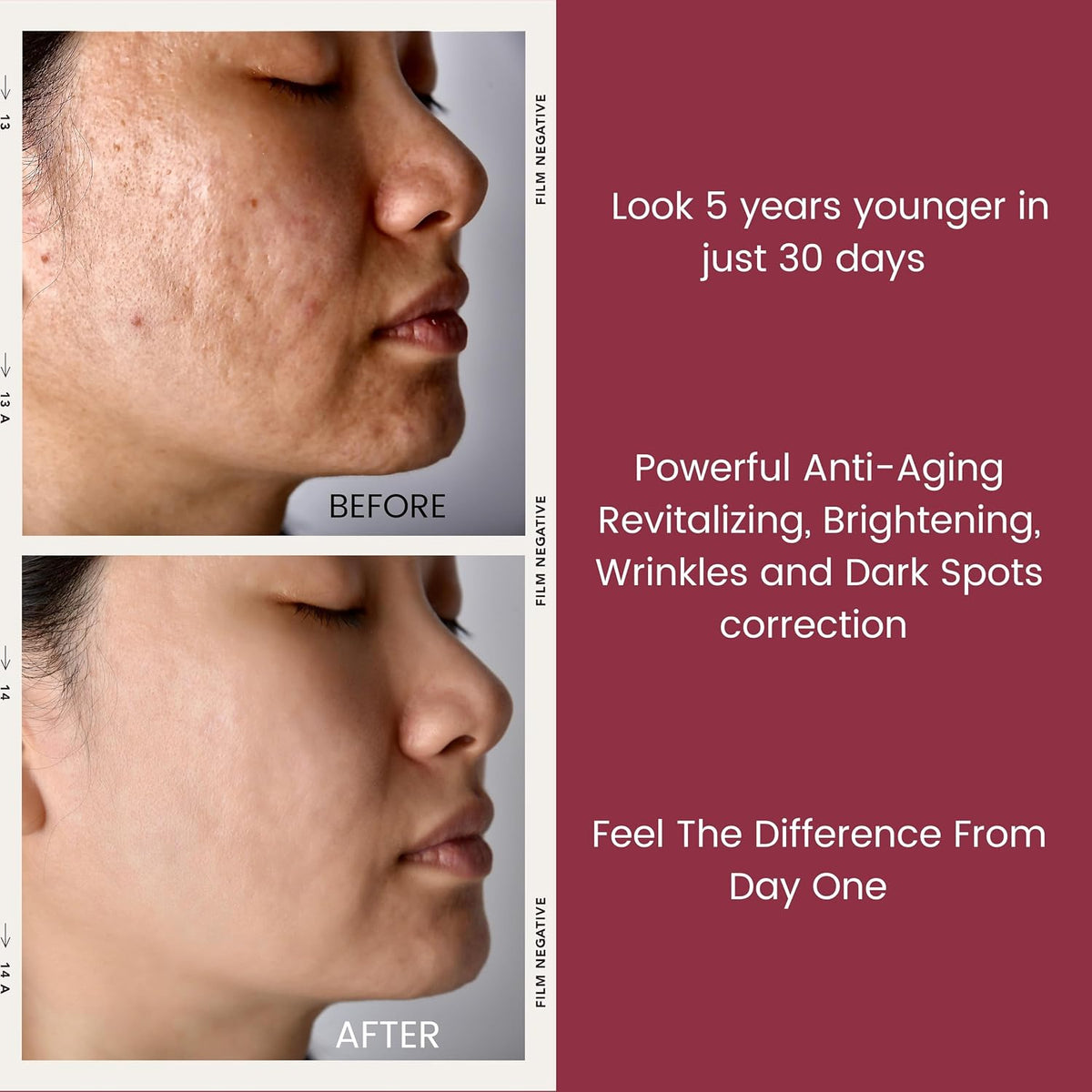 TURBINNE Cápsulas de suero de retinol puro al 2.5%. Luce 5 años más...