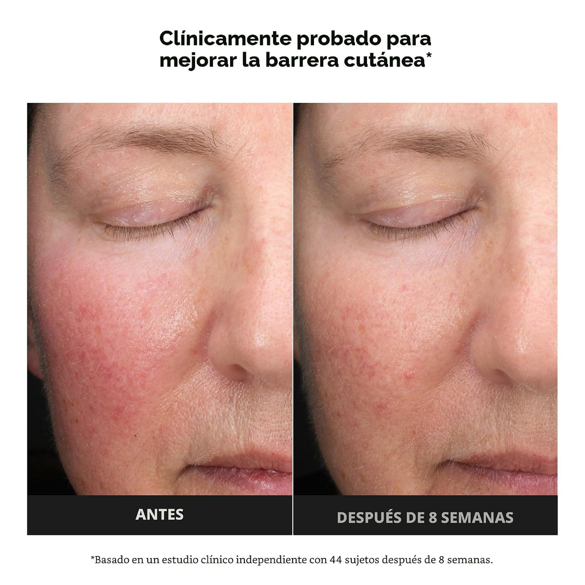 Paula's Choice 6% de ácido mandélico + 2% exfoliante de ácido l...