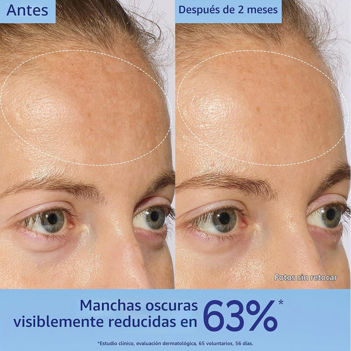 Caudalie Vinoperfect - Suero iluminador de manchas oscuras alternat...