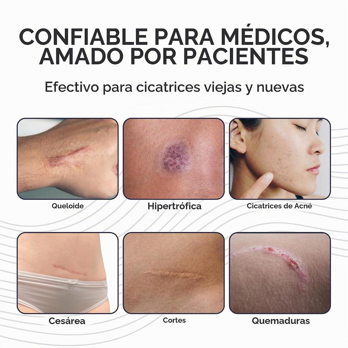 ProSil Elite Carry™ - Barra de gel para cicatrices de silicona, por...