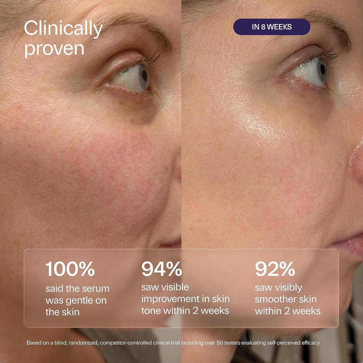 Wildfleur Suero de retinol al 0,3% para la cara, BR0.3 Bakuchiol su...