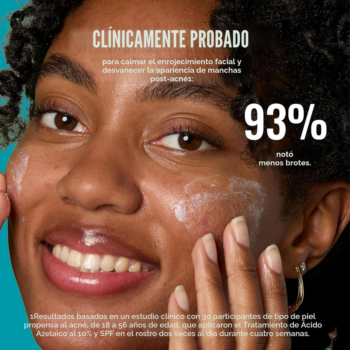 Good Molecules - Tratamiento de ácido azelaico al 10% para la cara,...