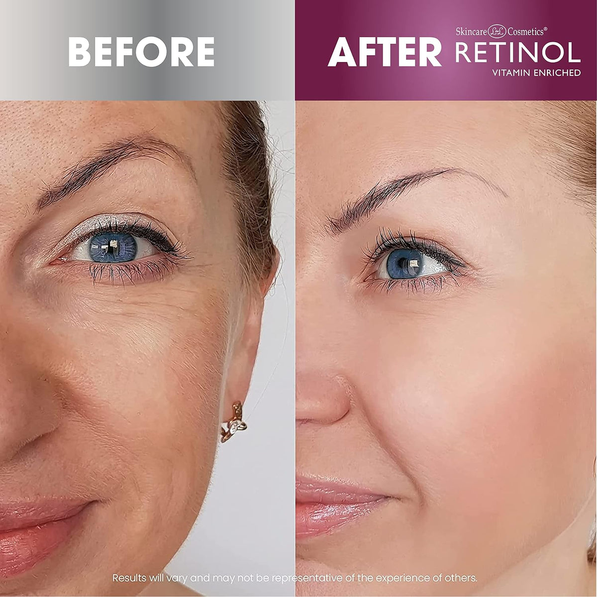 Retinol Super Face Lift: reafirma y aprieta visiblemente para un as...