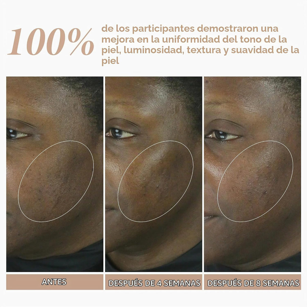 Shani Darden Reforma de retinol para el cuidado de la piel con suer...