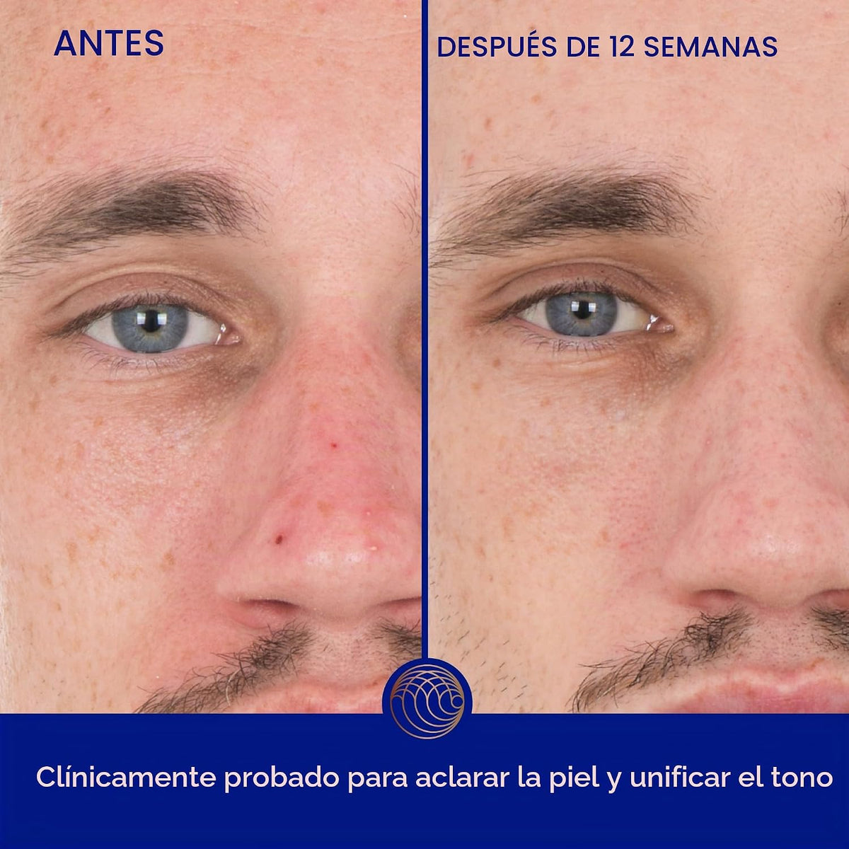 El suero de retinol