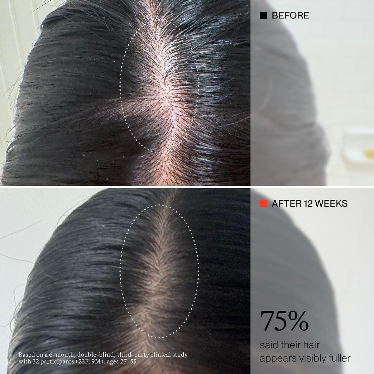 oneskin OS-01 HAIR Peptide Scalp Serum | Reduce la caída y apoya la...