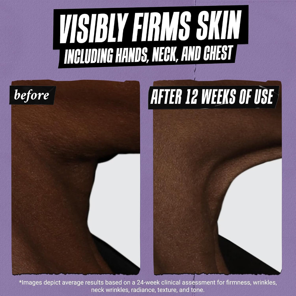 Kiehl's Suero facial de retinol antienvejecimiento de microdosi...