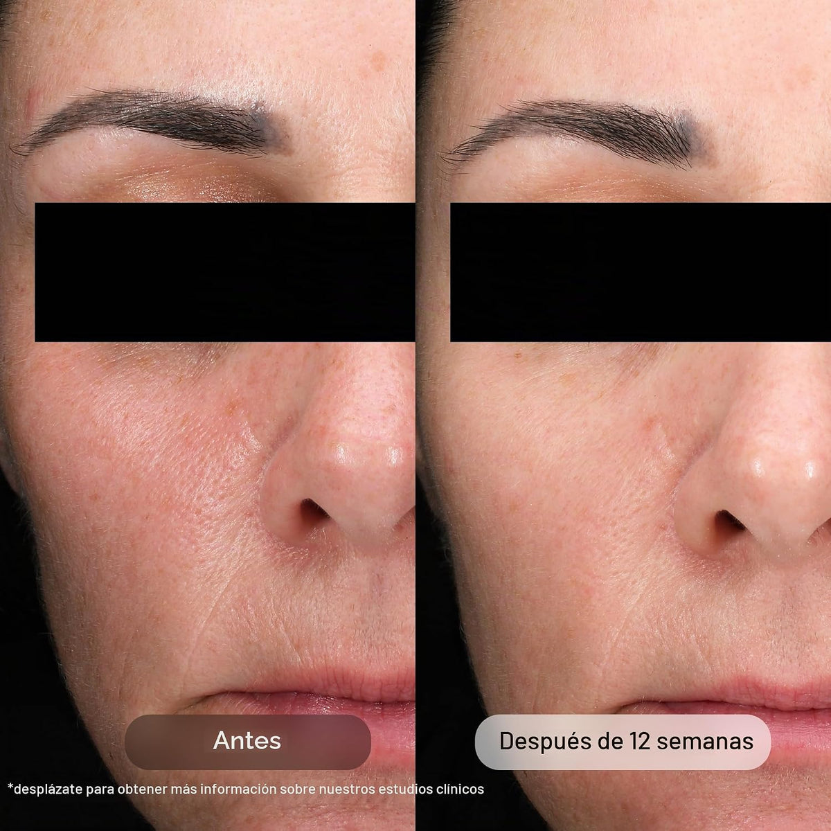 Revision Skincare D·E·J Daily Boosting Serum™, suero antienvejecimi...
