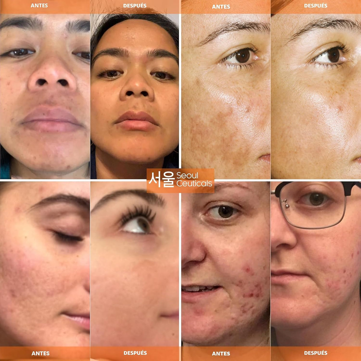 SeoulCeuticals Suero coreano con 20% de vitamina C para rostro + CE...