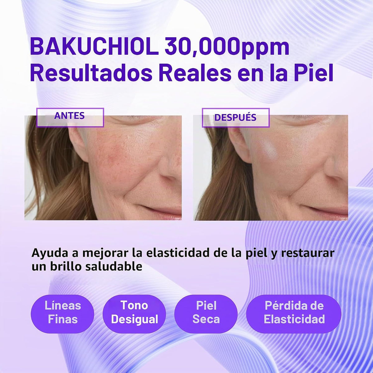 Serum concentrado coreano Bakuchiol mixto 30,000 ppm \u2013 Alterna...