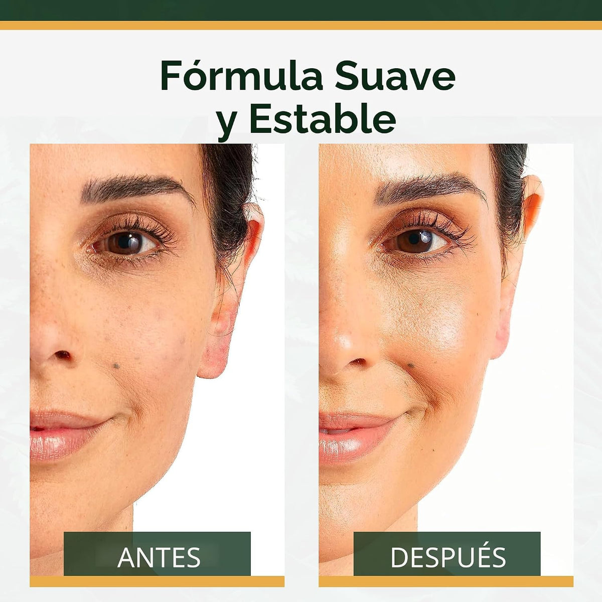Suero de vitamina C+ Tree of Life para la cara, aceite facial remov...