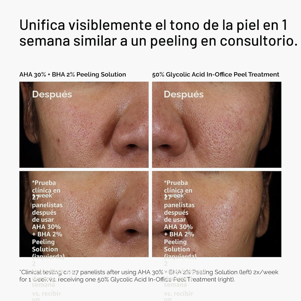 The Ordinary AHA 30% + BHA 2% Peeling Solution, exfoliante avanzado...