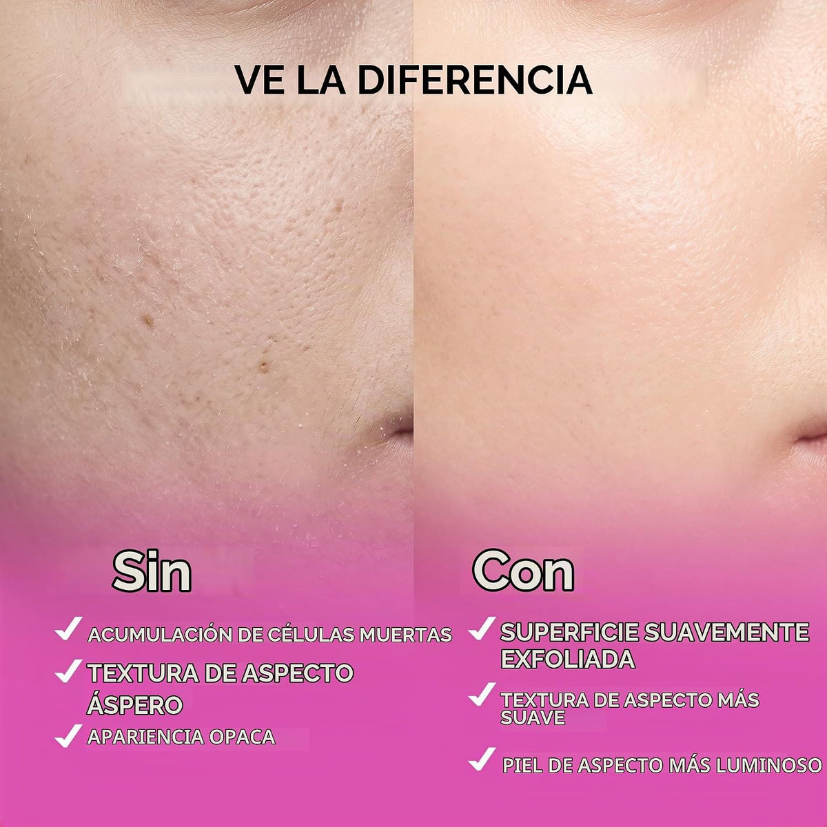 Ember Cloud Suero de ácido glicólico para rostro 15%, ácido láctico...