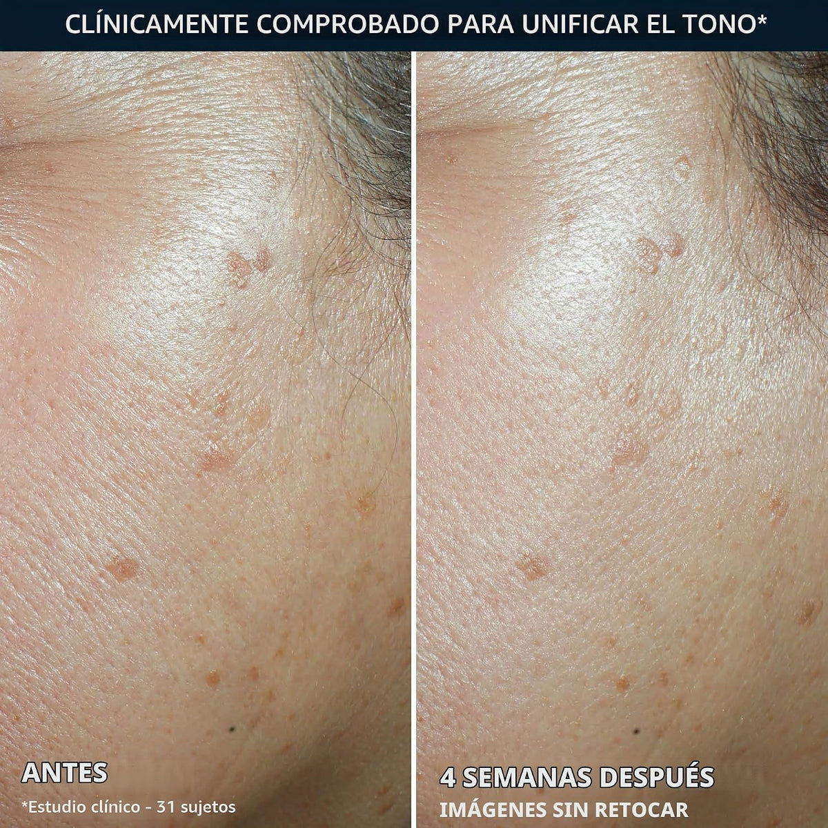 RoC Niacinamide Daily Face Moisturizer SPF 30, tono uniforme 5 en 1...