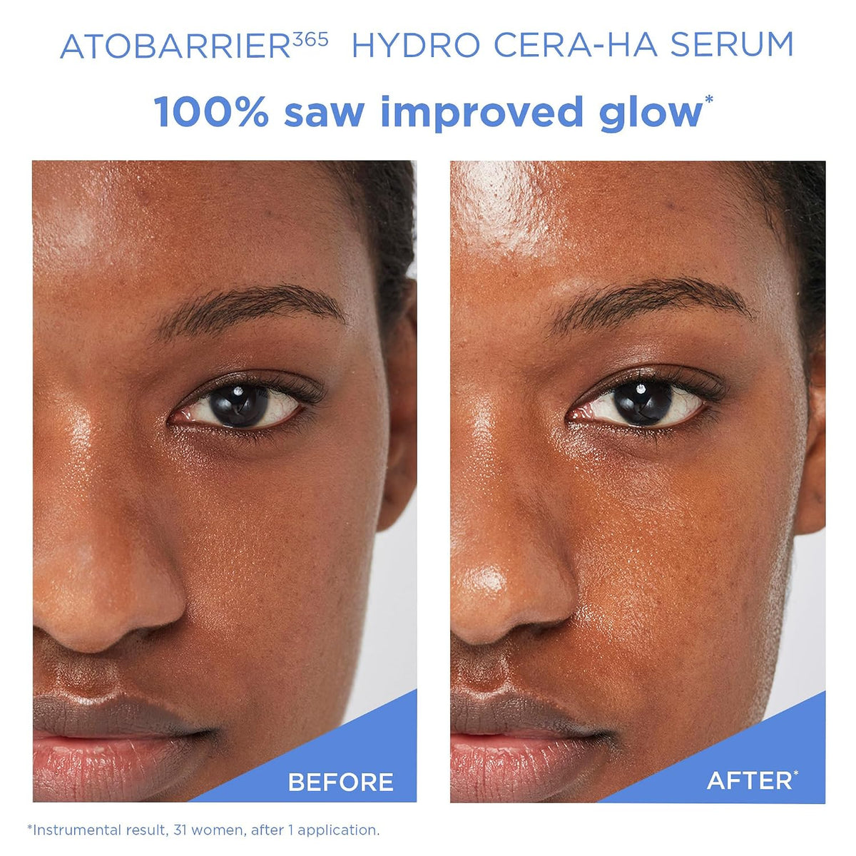 AESTURA ATOBARRIER365 Hydro CERA-HA Suero facial coreano, 30ML | Re...