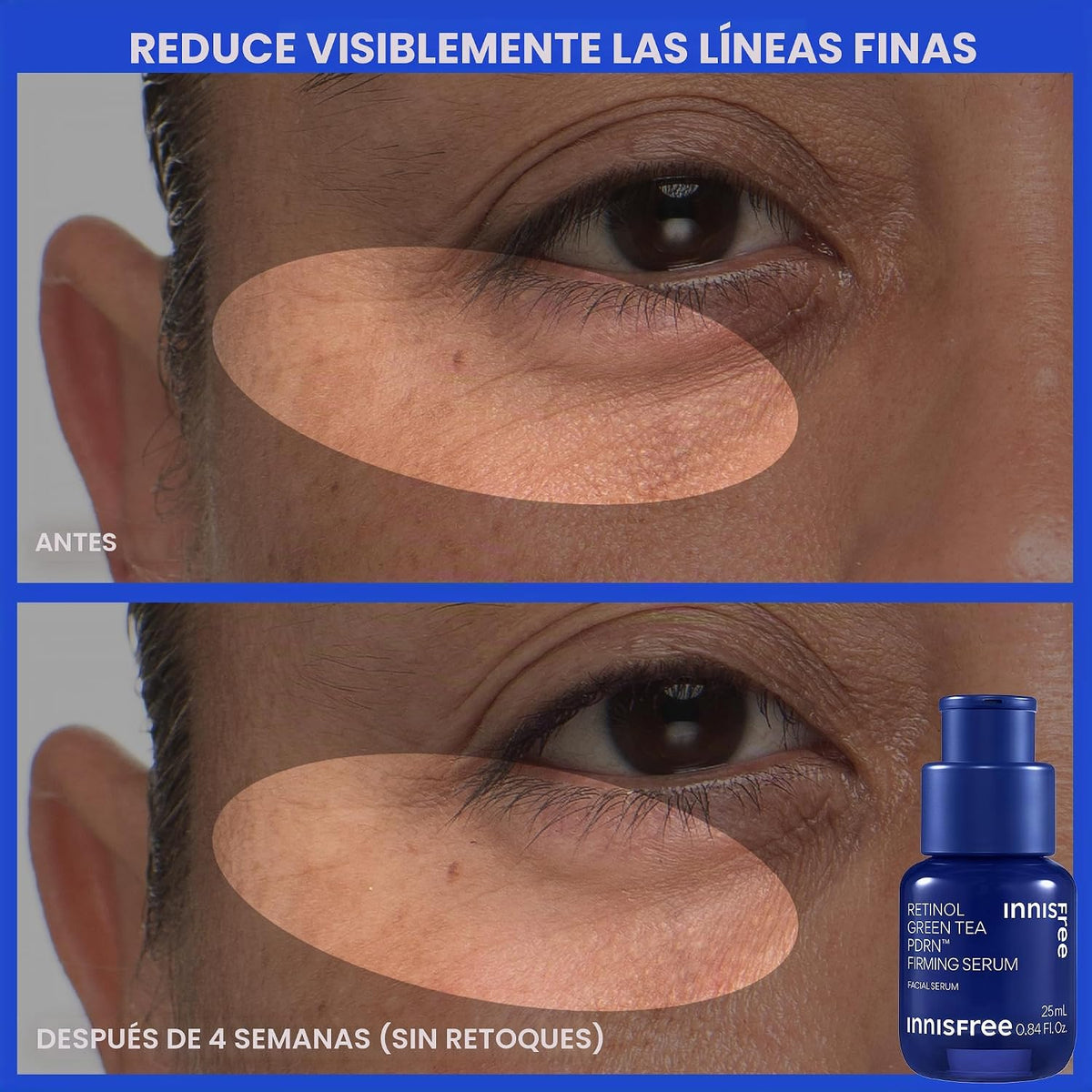 innisfree Suero PDRN de té verde | Cuidado de la piel coreano con r...