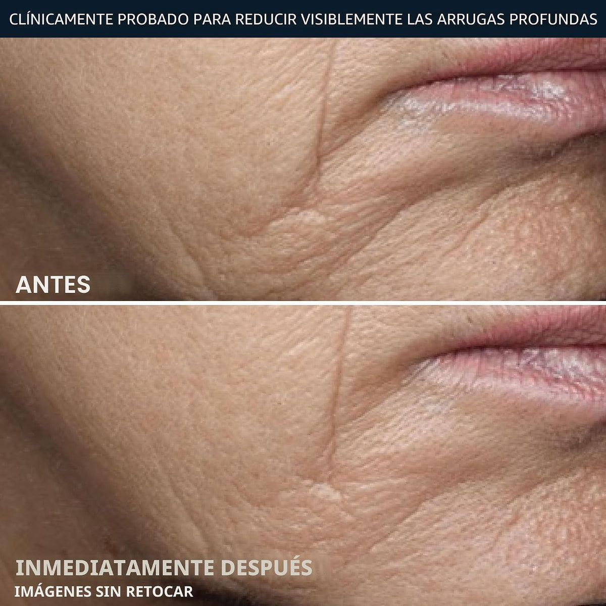 RoC Deep Wrinkle Rich Cream, crema reafirmante antienvejecimiento d...