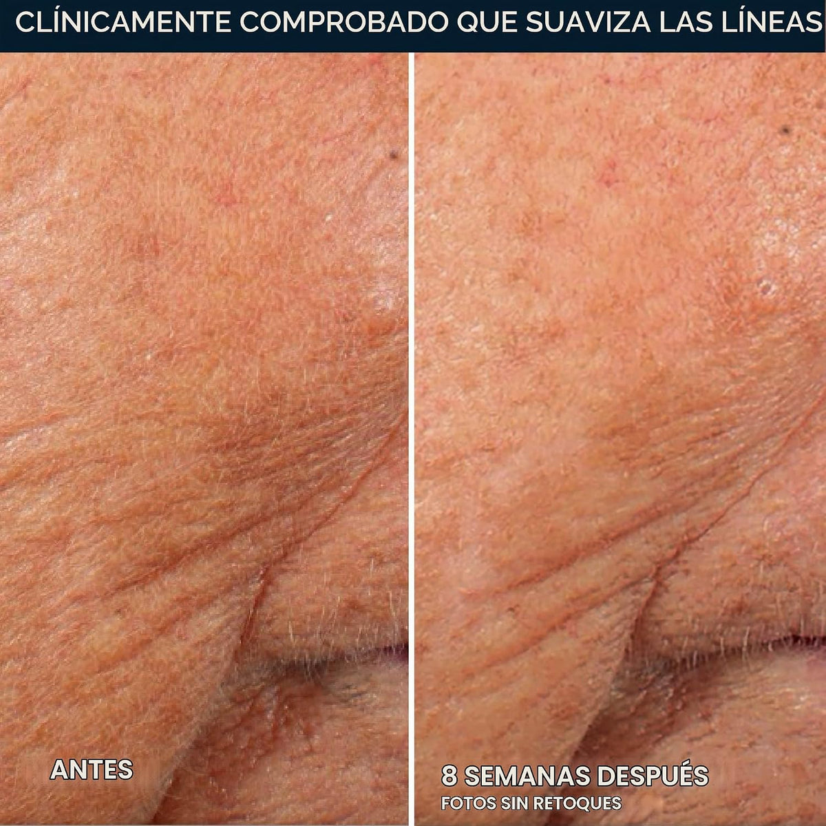 RoC Retinol Correxion Line - Cápsulas de suero de noche suavizante,...