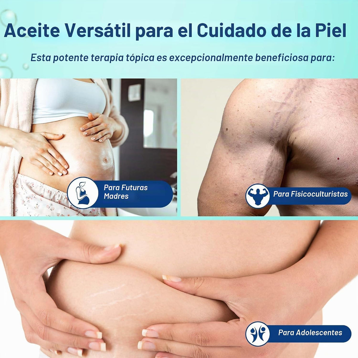 Aceite de estrías, minimiza el riesgo y la gravedad de las estrías,...