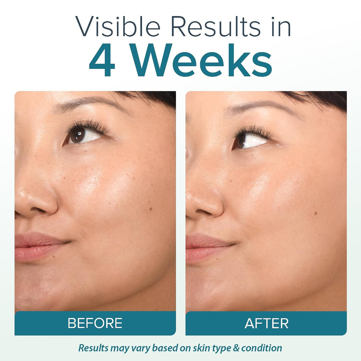 Ebanel Crema hidratante facial con 2.5% de retinol con péptidos, vi...