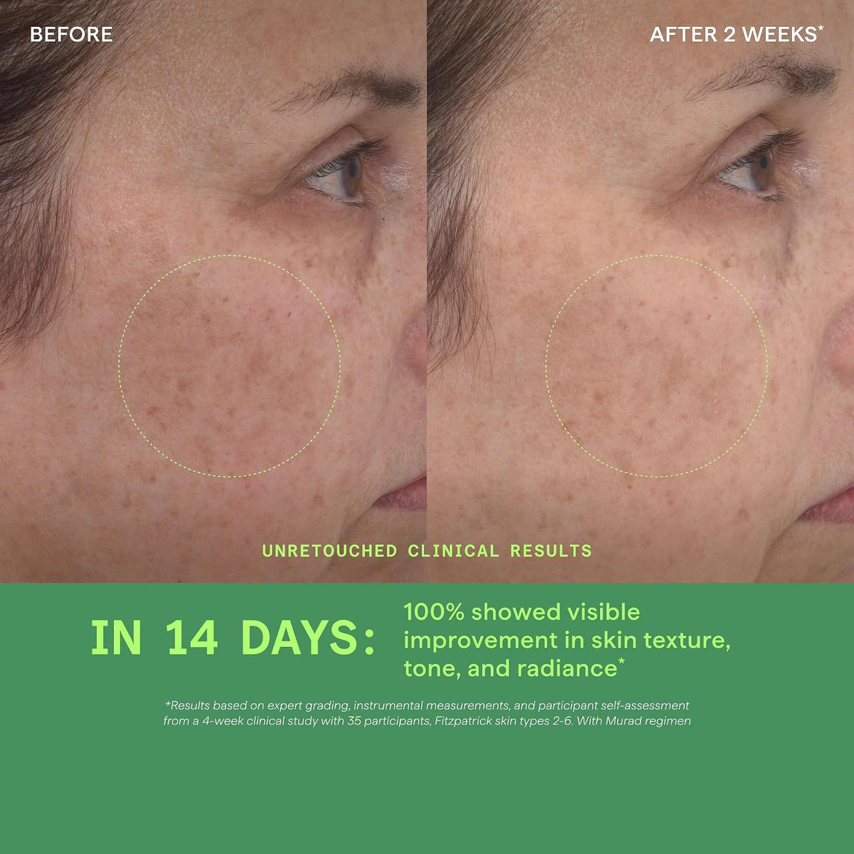 Murad Retinol Youth Renewal Serum - Suero avanzado antienvejecimien...