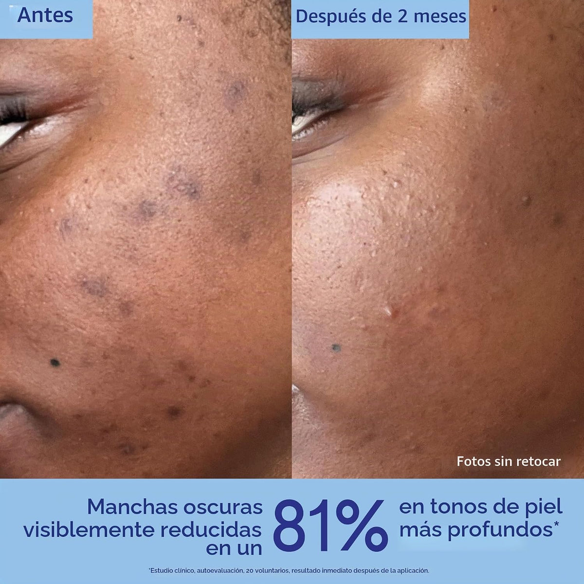 Caudalie Vinoperfect - Suero iluminador de manchas oscuras alternat...