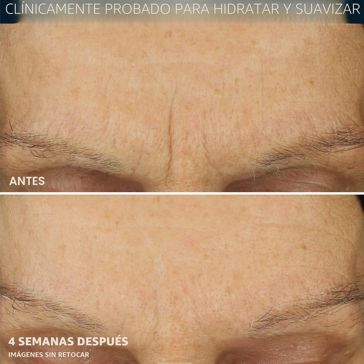RoC Retinol Correxion Max Hidratante facial de hidratación diaria,...