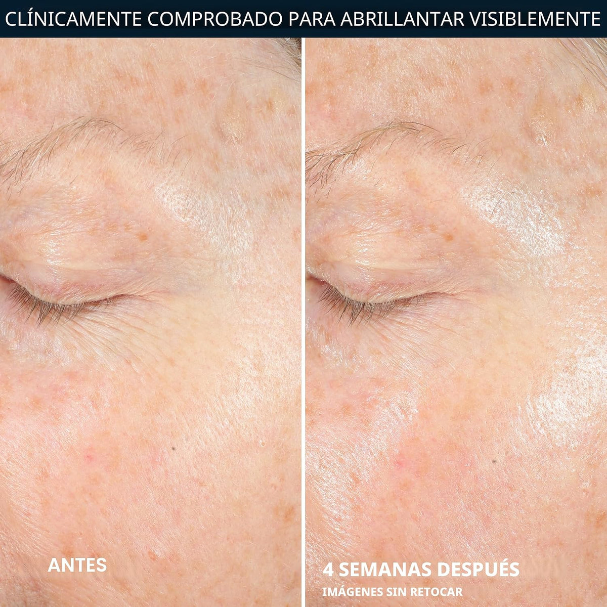 RoC Multi Correxion Revive + Glow 10% Vitamina C Hidratante para el...